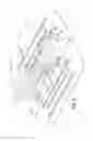 Fig. 04 - URINARY CATHETER STABILIZER AND METHOD OF USE
