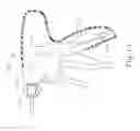 Fig. 11 - Selective activation of electronic components in medical device