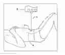 Fig. 01 - Laser guided auto collimation system and method for medical apparatus