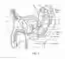 Fig. 02 - Systems and methods for prostate treatment