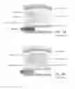 Fig. 04 - Systems and methods for prostate treatment