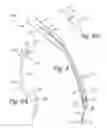 Fig. 06 - APPARATUS UTILIZING A GUIDE WIRE TO MANEUVER HEATING ELEMENT AND PROBE FOR TREATING DAMAGED SPINAL DISCS