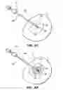Fig. 06 - Ablation probe with echogenic insulative sheath