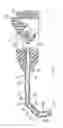 Fig. 08 - ARTICULATED SURGICAL PROBE AND METHOD FOR USE
