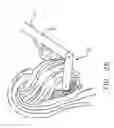 Fig. 22 - ARTICULATED SURGICAL PROBE AND METHOD FOR USE