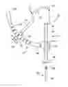 Fig. 01 - Apparatus and method for arthroscopic transhumeral rotator cuff repair