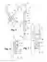 Fig. 02 - Apparatus and method for arthroscopic transhumeral rotator cuff repair