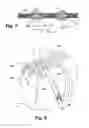 Fig. 05 - Apparatus and method for arthroscopic transhumeral rotator cuff repair