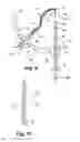 Fig. 06 - Apparatus and method for arthroscopic transhumeral rotator cuff repair