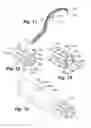 Fig. 07 - Apparatus and method for arthroscopic transhumeral rotator cuff repair