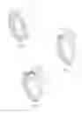 Fig. 02 - Arthroscopic joint repair