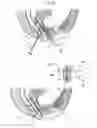 Fig. 09 - Surgical instrument