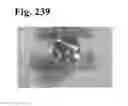 Fig. 239 - Adhesive compounds and methods use for hernia repair