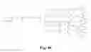 Fig. 85 - Adhesive compounds and methods use for hernia repair