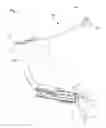 Fig. 02 - Devices and methods for producing anastomoses