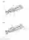 Fig. 04 - Devices and methods for producing anastomoses