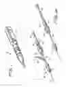 Fig. 02 - Rotational thrombectomy wire
