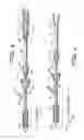 Fig. 04 - Rotational thrombectomy wire