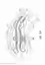 Fig. 43 - Rotational atherectomy device with distal protection capability and method of use