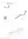 Fig. 06 - Intravascular Tissue Disruption