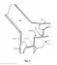 Fig. 02 - Method and system for balloon counterpulsation during aortic valve replacement