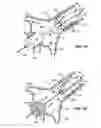 Fig. 07 - Method and system for balloon counterpulsation during aortic valve replacement