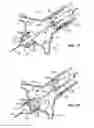 Fig. 08 - Method and system for balloon counterpulsation during aortic valve replacement