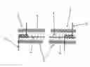 Fig. 01 - Micro-spiral implantation device