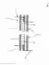 Fig. 04 - Micro-spiral implantation device