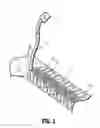Fig. 03 - Wound closure device including suction step sleeve