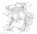 Fig. 01 - Craniospinal fusion method and apparatus