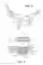Fig. 04 - Craniospinal fusion method and apparatus