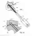 Fig. 07 - Bone Fixation Device and Methods for Use Thereof