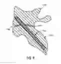 Fig. 08 - Bone Fixation Device and Methods for Use Thereof