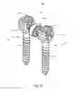 Fig. 18 - System and method for dynamic vertebral stabilization