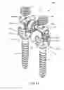 Fig. 22 - System and method for dynamic vertebral stabilization