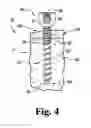 Fig. 04 - Multi-thread bone screw and method