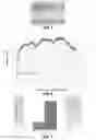 Fig. 07 - Fixation assembly having an expandable insert