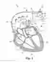 Fig. 02 - Performance assessment and adaptation of an acoustic communication link