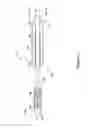 Fig. 02 - Occlusion crossing device and method