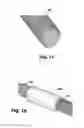 Fig. 07 - Compliant Venous Graft