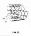 Fig. 09 - Compliant Venous Graft