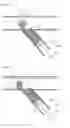 Fig. 07 - H-Side Branch Stent
