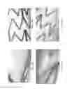 Fig. 06 - COATED MEDICAL DEVICES AND METHODS
