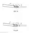Fig. 10 - Reliably retained shape memory ophthalmological implants