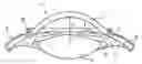 Fig. 01 - SYSTEM AND DEVICE FOR CORRECTING HYPEROPIA, MYOPIA AND PRESBYOPIA