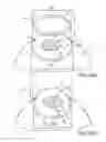 Fig. 04 - SYSTEM AND DEVICE FOR CORRECTING HYPEROPIA, MYOPIA AND PRESBYOPIA