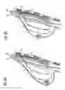 Fig. 06 - Breast implant system