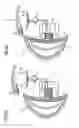 Fig. 08 - Breast implant system