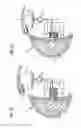 Fig. 12 - Breast implant system